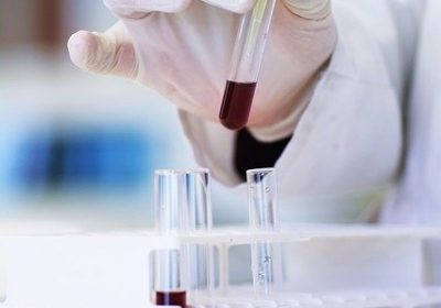 Covid-19 À quoi servent les tests ?