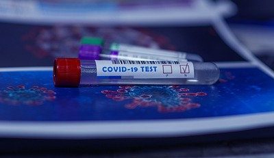 Covid-19 Ça bouge au niveau des tests