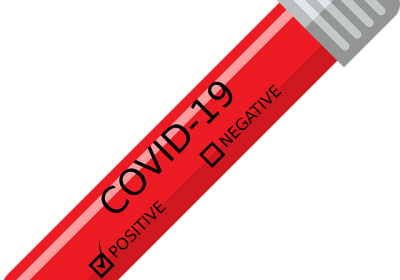 Covid-19 Feu vert pour proposer des tests en pharmacie